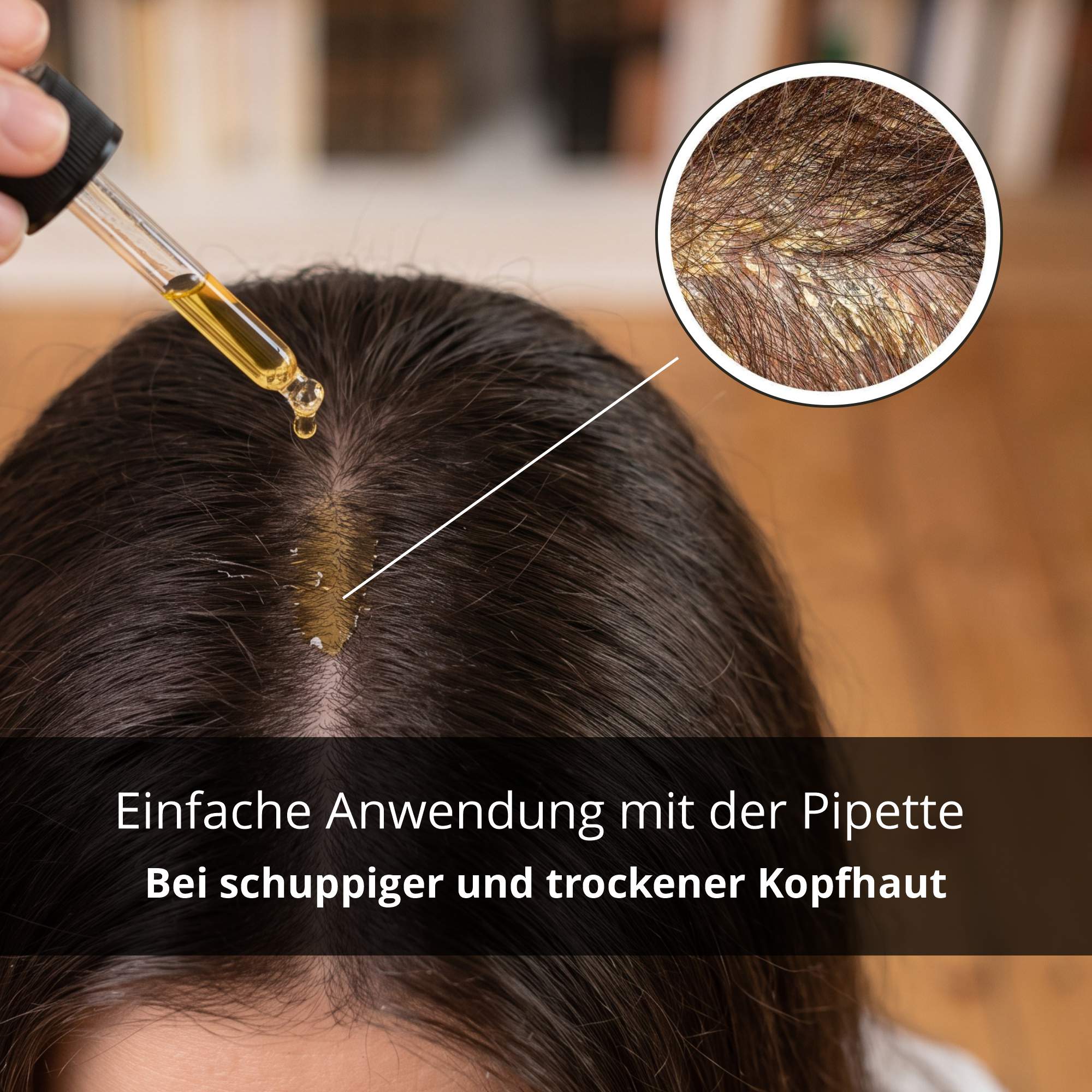 NeuroPsori BIO-Hautöl - mit Nachtkerzenöl, bei Neurodermitis und Schuppenflechte