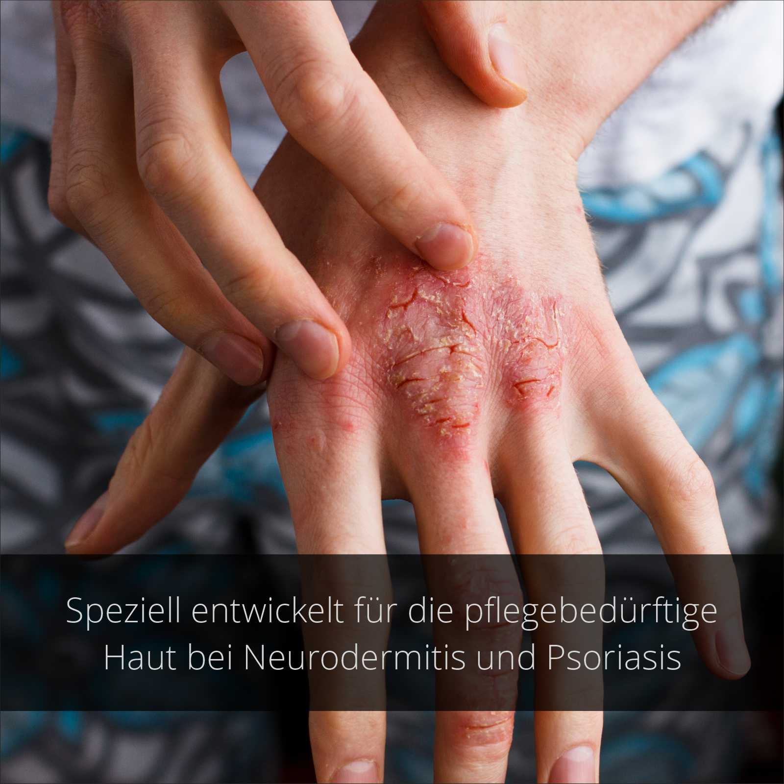 NeuroPsori-Set - Hautpflege bei Schuppenflechte und Neurodermitis
