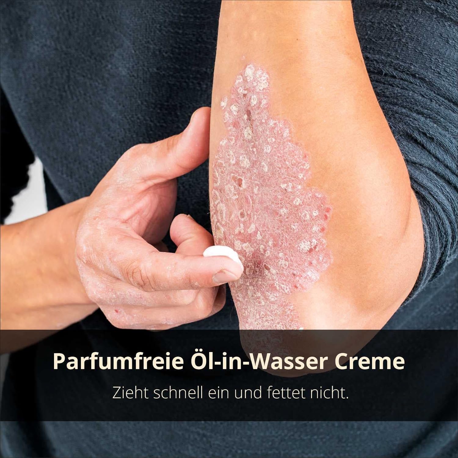 PSO Intensivcreme - Hautpflege bei Psoriasis, trockene Haut, 50ml