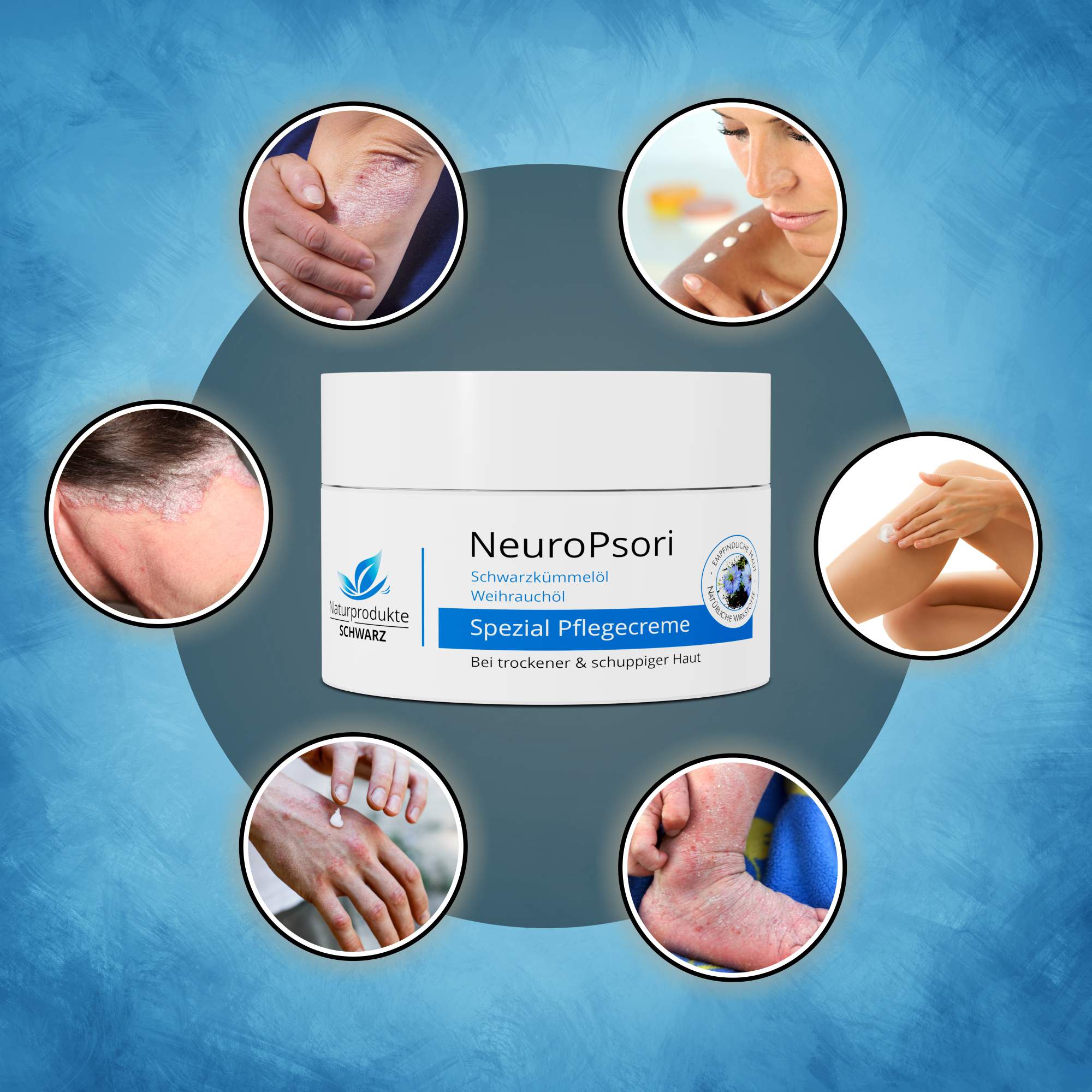 NeuroPsori Spezialpflege Creme - Pflege bei Neurodermitis und Schuppenflechte
