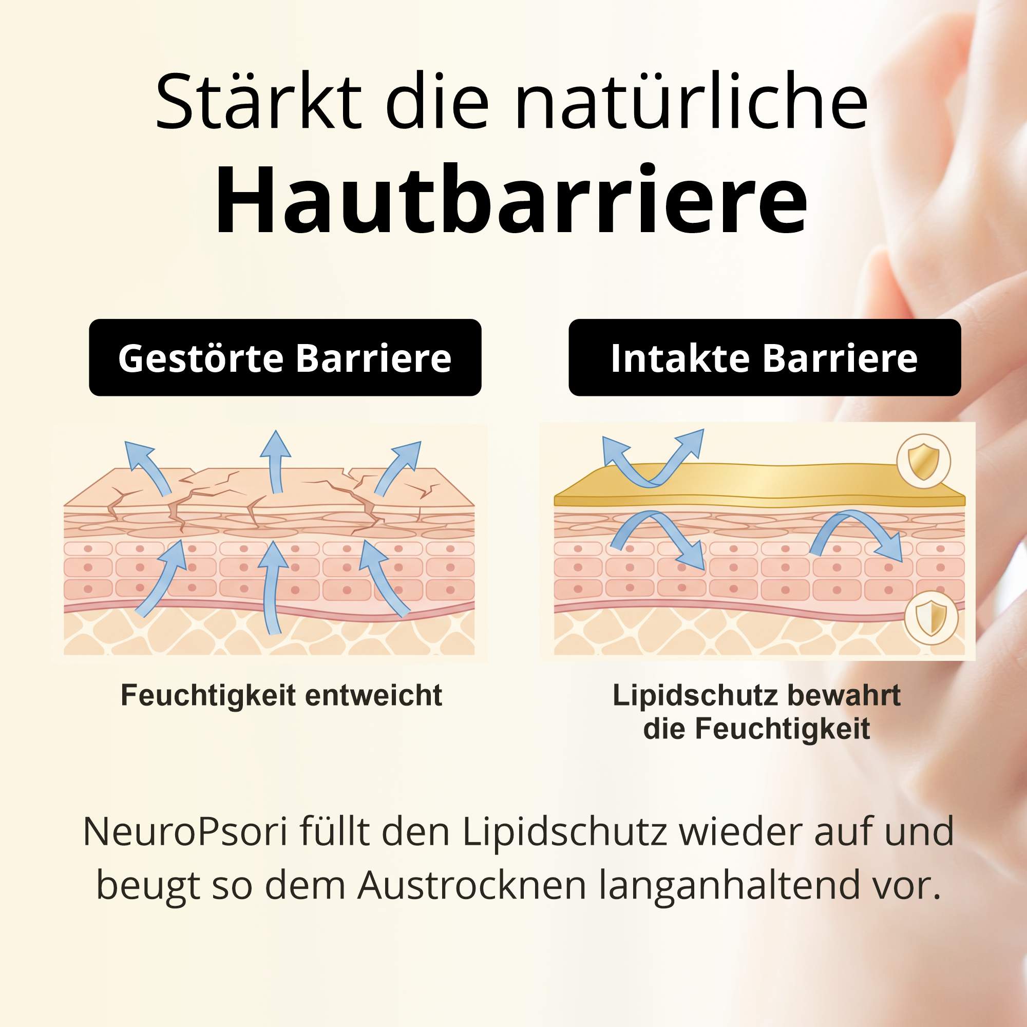 NeuroPsori BIO-Hautöl - mit Nachtkerzenöl, bei Neurodermitis und Schuppenflechte